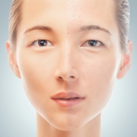 Diet Change = Clear Complexion